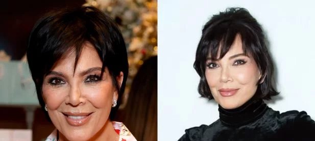 Kris Jenner cria “senha secreta” para que amigos agendem consultas com seu cirurgião plástico - Imagem do artigo