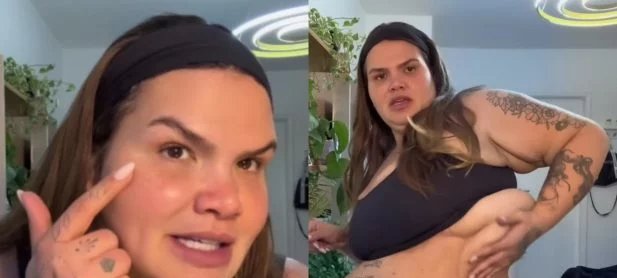 Thais Carla detalha mudanças corporais após eliminar 75 kg e exibe cicatrizes da bariátrica - Imagem do artigo