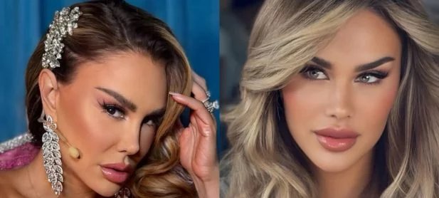 Ninel Conde muda cor dos olhos para verde oliva em cirurgia nos EUA e gera debate na web - Imagem do artigo